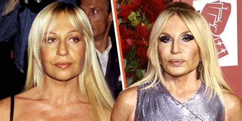 donna versace before and after surgery|donatella Versace then and now.